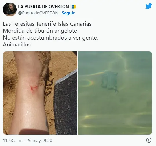 mordida un tiburón angelote muerde a un bañista en la playa de las Teresitas en Tenerife Canarias